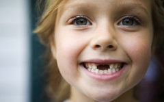 Смена зубов у детей