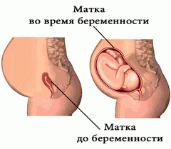 От кумыса болит голова
