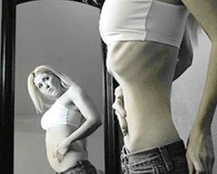 Главный симптом анорексии - сильное похудение