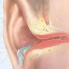 Наружный отит – заболевание внешнего ушного канала
