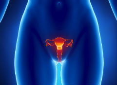 На первой стадии рака эндометрия проводят удаление тела, шейки матки и придатков с двух сторон