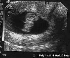 Размер плода на 8 неделе беременности - 14-19 мм