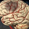 Чистка сосудов головного мозга