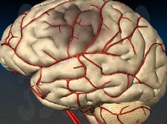 Чистка сосудов головного мозга - метод профилактики и лечения атеросклероза