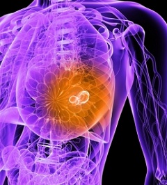 Маммолог - врач, проводящий диагностику рака груди