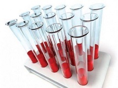 Совместимость групп крови важна при переливании