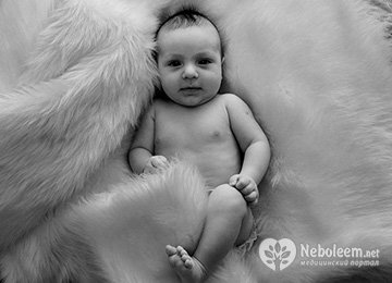 Водянка яичек у новорожденных - лечение и диагностика