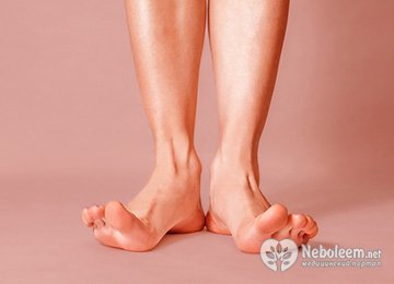 Синдром беспокойных ног - лечение и профилактика
