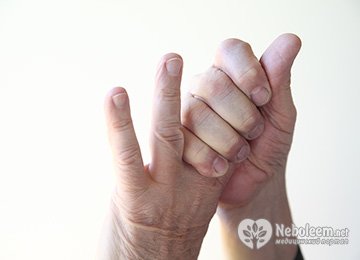 Онемение пальцев левой руки - причины и лечение