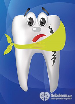 Болит зуб под пломбой - пульпит или периодонтит