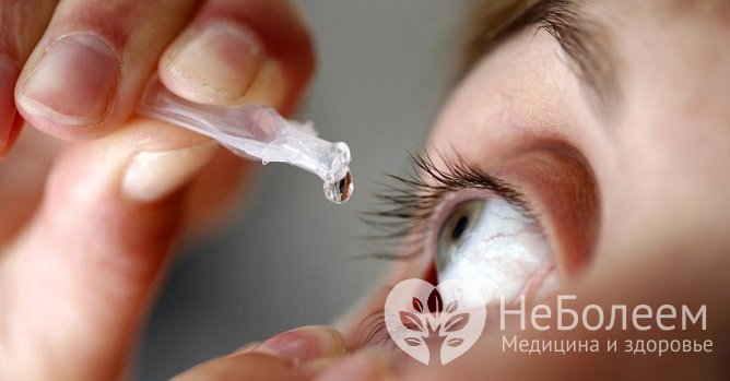 Для лечения аденовирусного конъюнктивита назначают противовирусные глазные капли