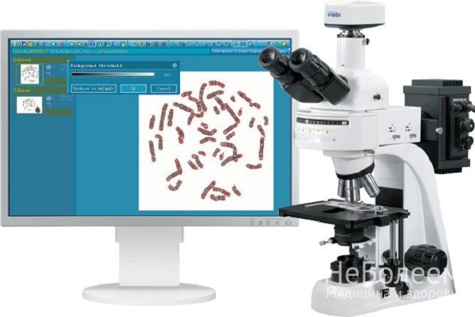 Изучение набора хромосом или кардиотипирование – основной метод диагностики анеуплоидии