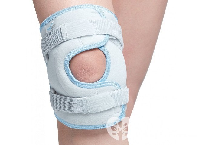 Артроз коленного сустава нередко является отдаленным следствием травмы: перелома, ушиба, вывиха, растяжения