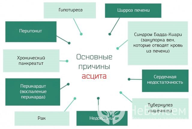 Основные причины асцита