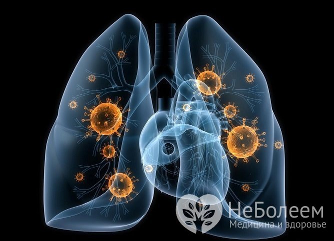 Возбудителями атипичных пневмоний становятся многочисленные инфекционные агенты