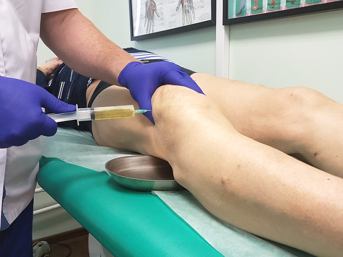 Пункция бурсы коленного сустава – один из методов лечения бурсита