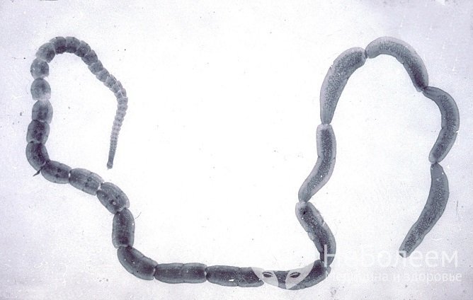 Возбудитель дипилидиоза – ленточный червь Dipylidium caninum