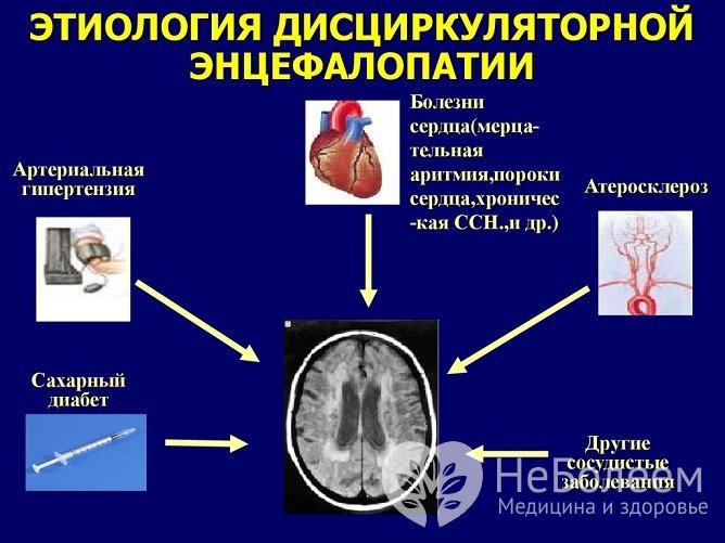 Этиология дисциркуляторной энцефалопатии