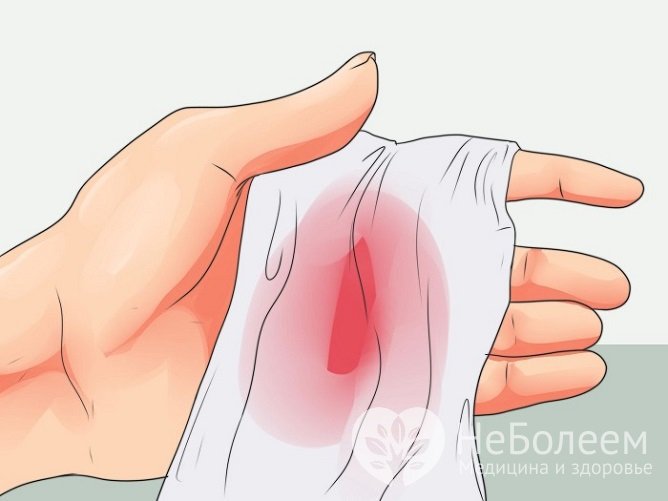 Кашель с кровью – один из симптомов гемосидероза