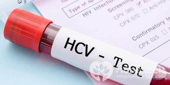 Для выявления вируса гепатита С нужно сдать кровь на анализ