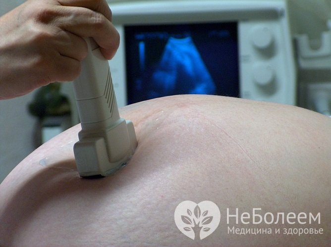 УЗ-допплерография позволяет оценивать состояние плода у беременных с гестозом