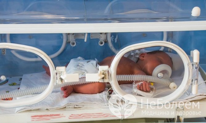 Гипоксия у новорожденных: симптомы и лечение