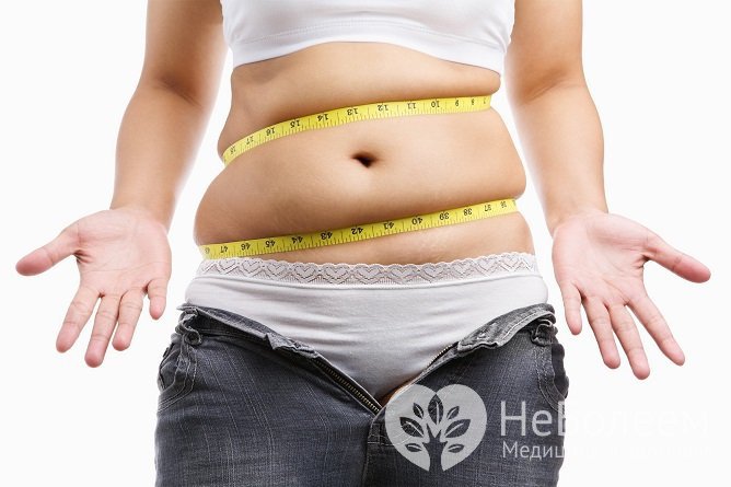 Избыточный вес относится к факторам риска развития грыжи белой линии живота