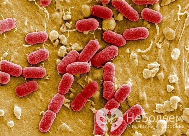 Причиной кишечных инфекций в большинстве случаев служат бактерии и вирусы
