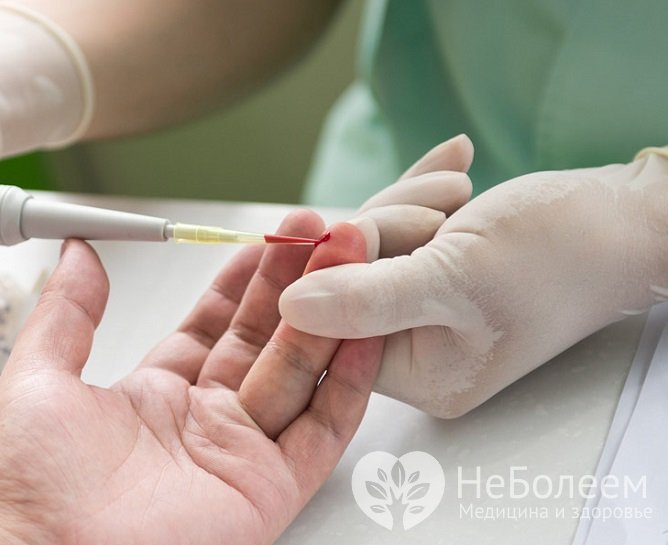 Лечение лейкопении проводится под контролем анализов крови