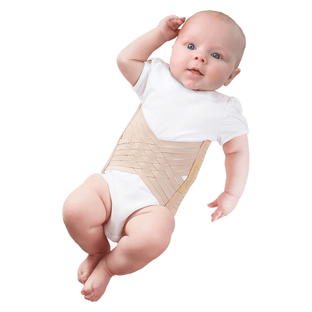 При пупочной грыже новорожденному могут назначать ношение специального бандажа