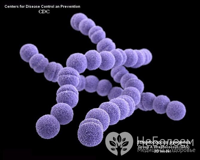 Пиогенный стрептококк – один из наиболее частых возбудителей болезни среди бактерий