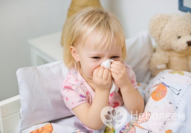 Вазомоторный ринит – частый спутник детей с воспаленными аденоидами