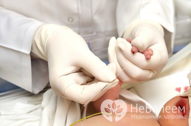 Диагноз «врожденный гипотиреоз» ставится на основании анализа крови на уровень гормонов