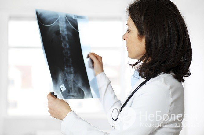 Диагностика защемления седалищного нерва включает рентгенографию области поясницы и таза