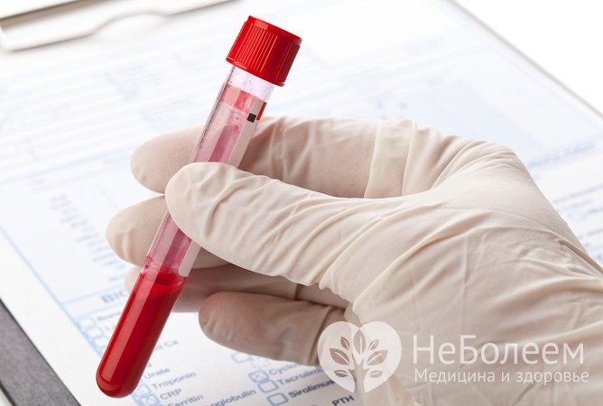 Содержание инсулина в крови определяется при помощи анализа крови
