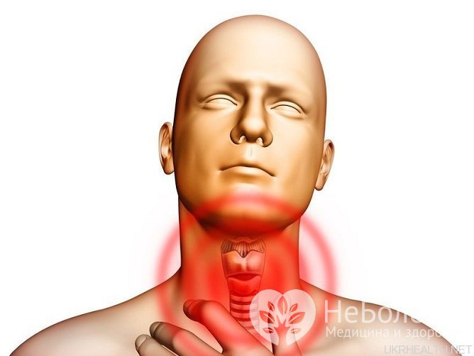Болезнь чаще всего проявляется сухостью, першением и жжением в горле