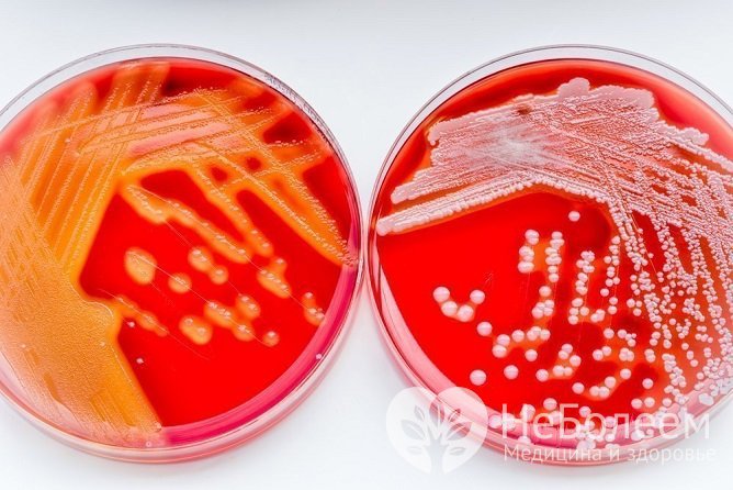 Если возбудителем болезни являются бактерии, необходимо применение антибиотиков