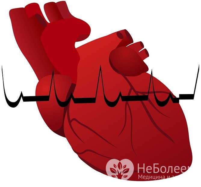 Мелкоочаговый инфаркт часто остается нераспознанным и обнаруживается лишь спустя некоторое время
