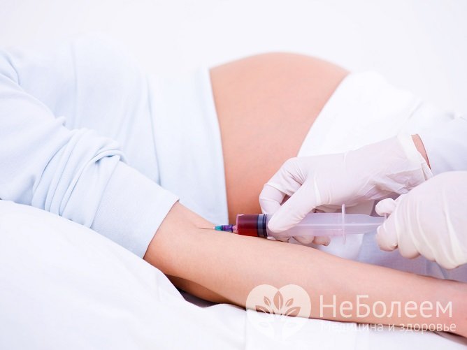 В норме высокий прогестерон наблюдается только при беременности, его снижение запускает родовую деятельность