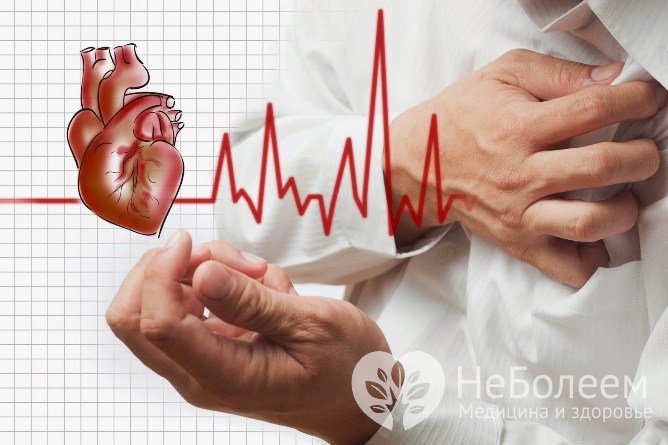 Инфаркт сопровождается болью высокой интенсивности, способной вызвать болевой шок, которая называется ангинозной