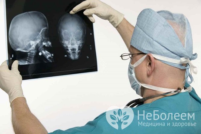 Перед проведением процедуры может быть назначена рентгенография или компьютерная томография