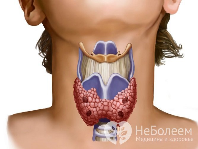 Заболевания щитовидной железы влияют на синтез ею тиреоидных гормонов