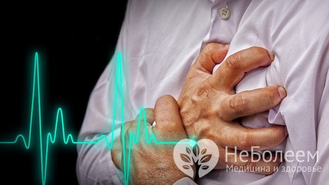 Ангинозная форма инфаркта проявляется острой сердечной болью высокой интенсивности