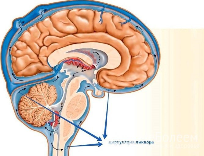 Черепная гипертензия вызывается нарушением ликворотока в головном мозге