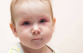 Болезни глаз у детей