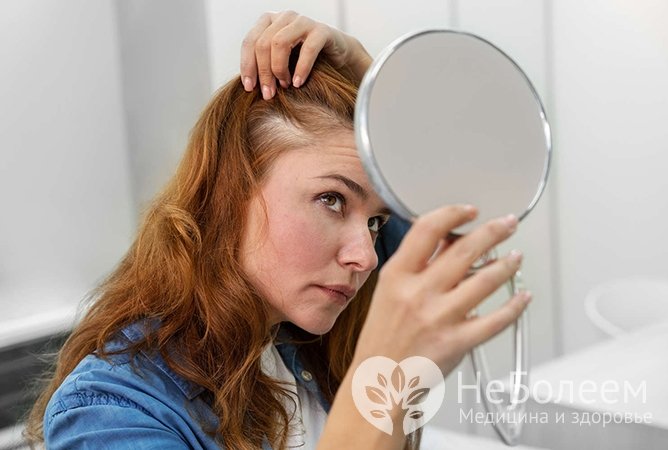 Выпадение волос при климаксе: есть ли способы остановить процесс?
