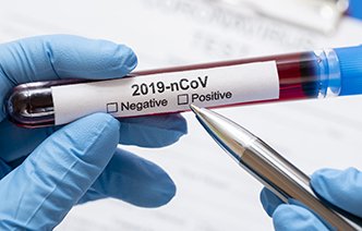 Тесты на коронавирус и потребность в них