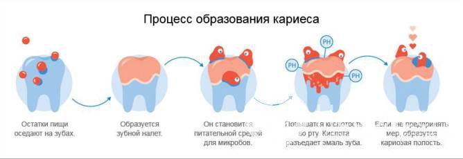 Откуда берутся кариес и другие заболевания полости рта?