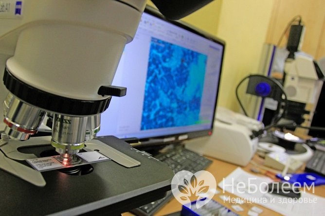 В осложненных случаях для подтверждения диагноза требуется проведение микроскопии