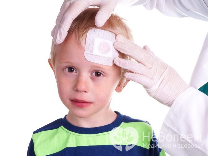 Образование эпидуральной гематомы происходит в результате черепно-мозговой травмы
